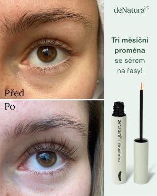 Naše zákaznice po třech měsících používání séra na řasy: „Dobrý den, chci vám moc poděkovat za sérum, jsem nesmírně...