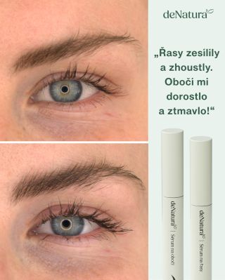 Přirozené výsledky naší zákaznice Aničky, které mluví samy za sebe. Kombinace séra na řasy a séra na obočí pomáhá podpořit...